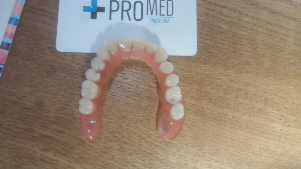 protezy na miniimplantach